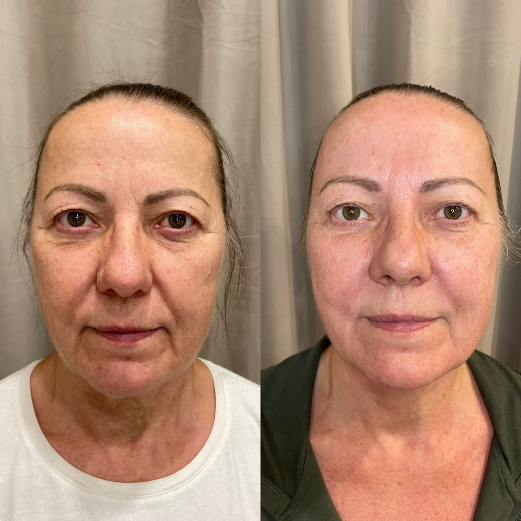 iFace masažo mokymai