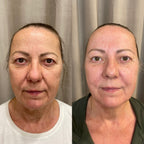 iFace masažo mokymai